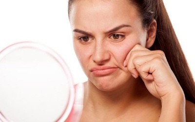 5 способів позбутися опухлого обличчя